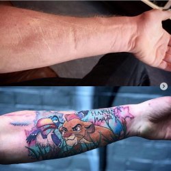 Татуировки, которые превращают недостатки кожи в изюминку 4