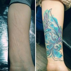 Татуировки, которые превращают недостатки кожи в изюминку 0