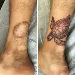 Татуировки, которые превращают недостатки кожи в изюминку 15