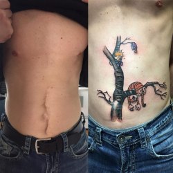 Татуировки, которые превращают недостатки кожи в изюминку 16
